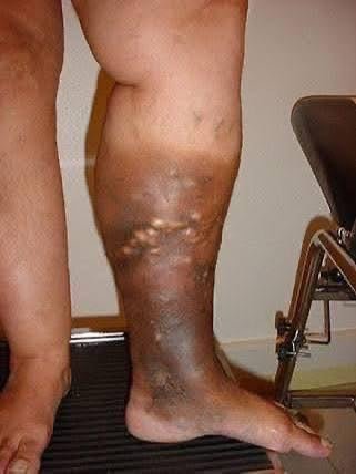 The First Signs Your Body Sends — And Why Most People Miss Them