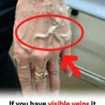 Visible Veins Explained! Normal Causes, Health Risks, and When to Worry
