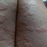 HT! These are the consequences of sleeping co!