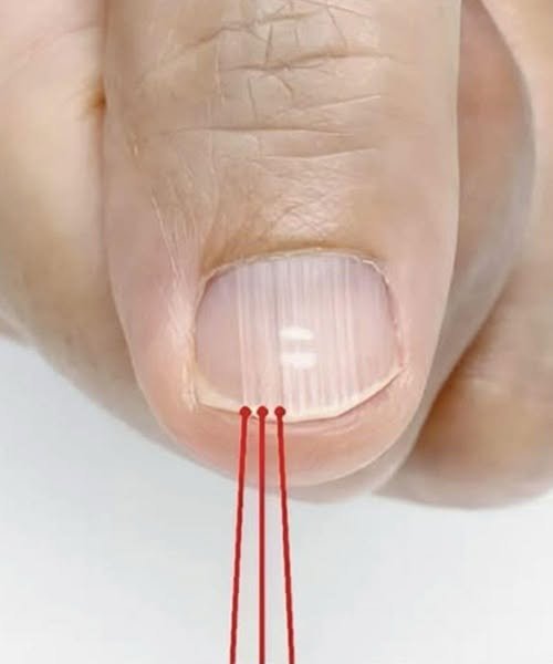 If You Have These Lines on Your Nails After 40, It Is a Clear Sign That…