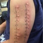 These are the consequences of sleeping with the…