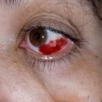 These are the consequences of sleeping with a… See more