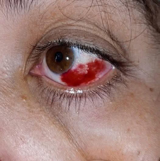 These are the consequences of sleeping with a… See more