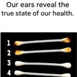 Our ears reveal our true state of health