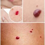 If You Spot These Red Dots on Your Skin, Here’s What They Mean 