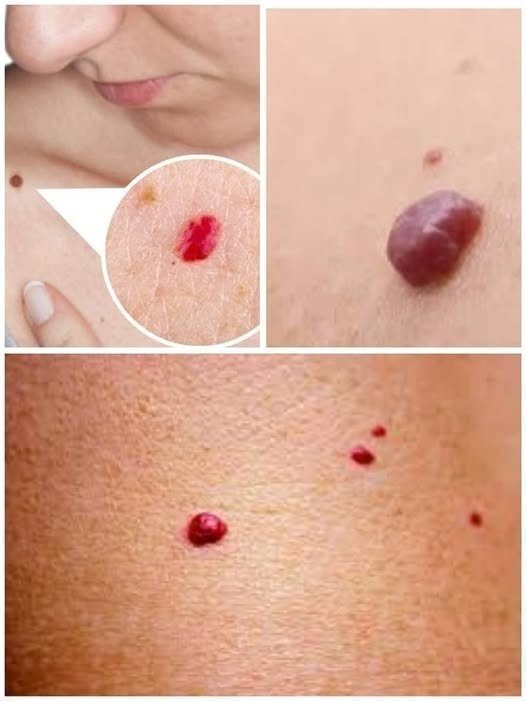 If You Spot These Red Dots on Your Skin, Here’s What They Mean 