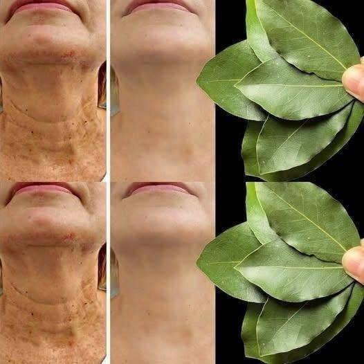  What Bay Leaves Actually Do for Skin (The Truth)
