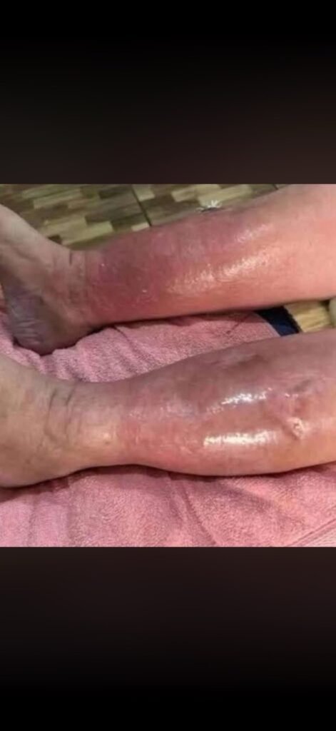 These Are Clear Signs That He Is Cr…&nbsp;