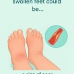 Poor Circulation: The Subtle Signs Your Blood Flow May Be Struggling