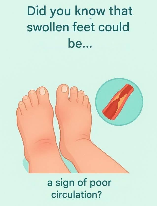 Poor Circulation: The Subtle Signs Your Blood Flow May Be Struggling