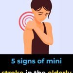 The Quiet Warning Signs of a Mini-Stroke in Older Adults