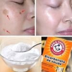 Can Baking Soda Really Reduce Age Spots? What It Does — And What It Doesn’t
