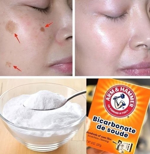 Can Baking Soda Really Reduce Age Spots? What It Does — And What It Doesn’t