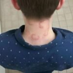 When Full-Body Itching Isn’t Just an Allergy — What His Diagnosis Tells Us