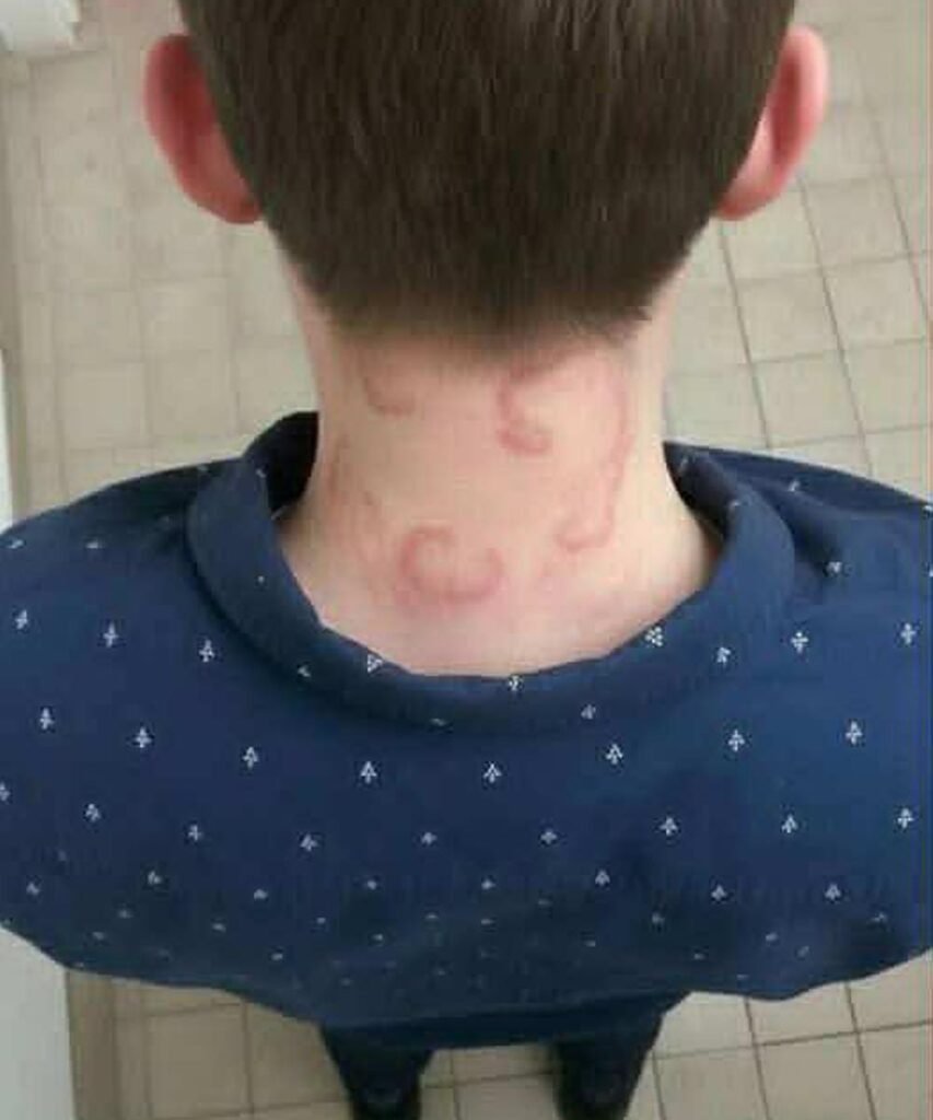 When Full-Body Itching Isn’t Just an Allergy — What His Diagnosis Tells Us