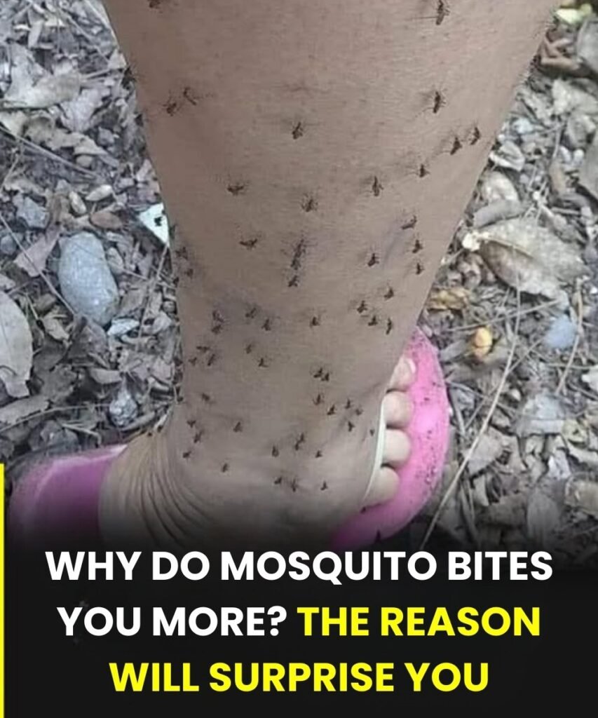 Why Mosquitoes Always Seem to Bite You — The Science Most People Don’t Know