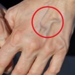 When Your Veins Start Showing Through Your Skin, What Your Body May Be Telling You