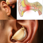 Garlic and Your Ears: What Science Actually Says About Relief and Protection