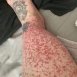 The Hidden Consequences of Sleeping With the Wrong Person