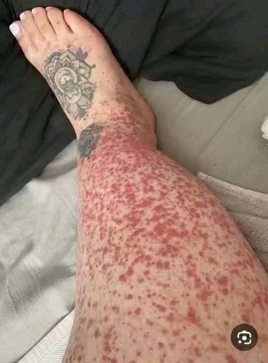 The Hidden Consequences of Sleeping With the Wrong Person