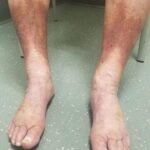 What Changes in Your Feet Can Reveal About Vein Health — and When to Pay Attention