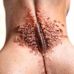 When a Single Image Stops You Mid-Scroll: What Disturbing Skin Photos Can Really Mean