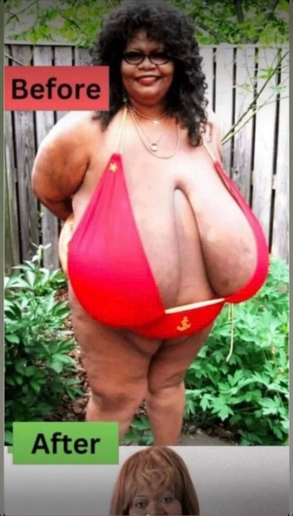 The World’s Waistline: A Quiet Crisis in Plain Sight