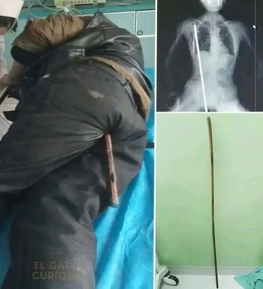 BREAKING: Young Man Hospitalized After Arrest Sparks Questions About Police Encounter