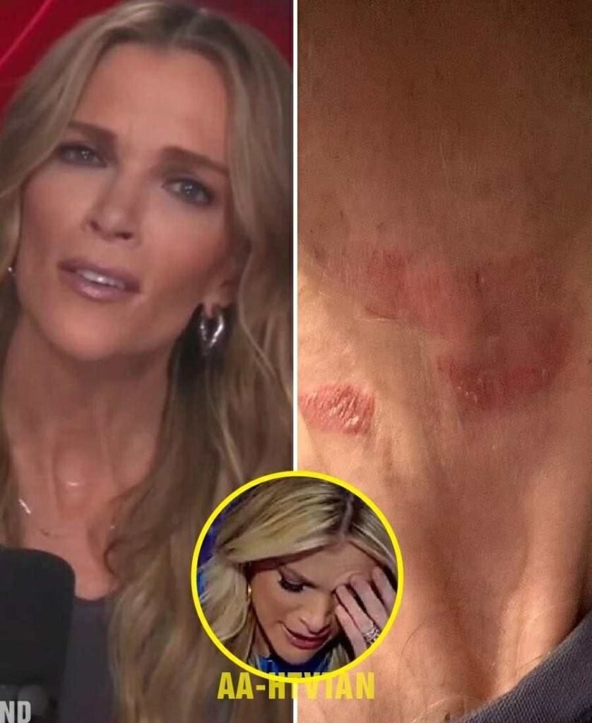 Reports About Megyn Kelly’s Health Circulate Online — What’s Actually Known So Far