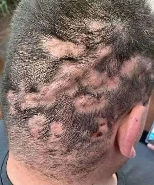 These Are the First Symptoms That May Appear After Sleeping With Someone