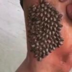 Acne Isn’t Random: What Really Causes Breakouts on Your Skin