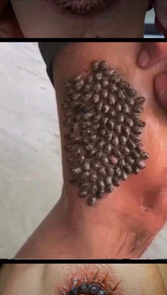 Acne Isn’t Random: What Really Causes Breakouts on Your Skin