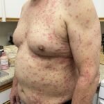 When Your Skin Won’t Stop Itching: What Your Body Might Be Trying to Tell You