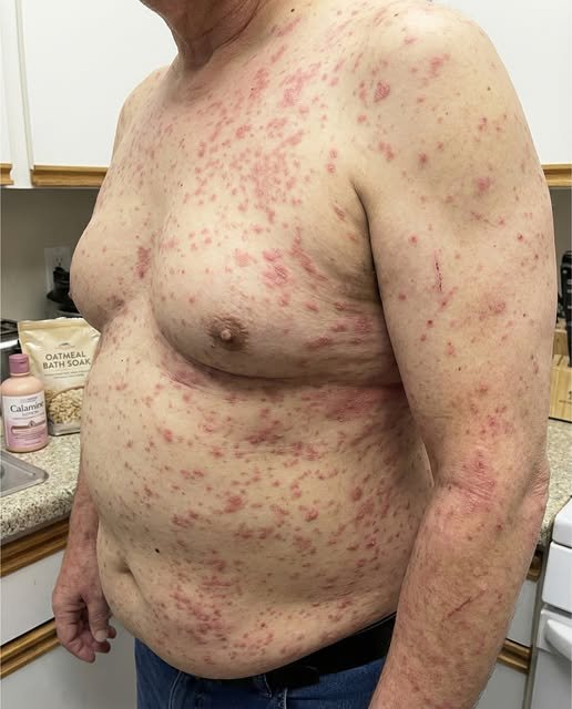 When Your Skin Won’t Stop Itching: What Your Body Might Be Trying to Tell You